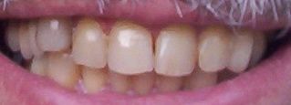 [teeth]